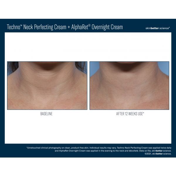 Techno Neck Perfecting Cream 50mL